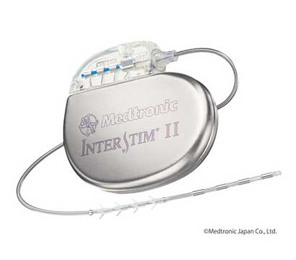 仙骨神経刺激療法(SNM)業務