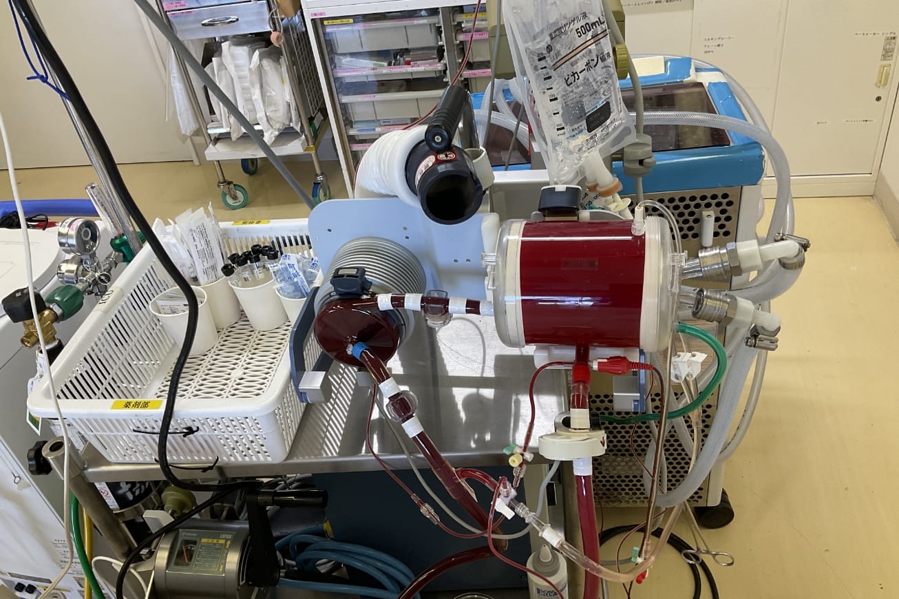 補助循環(ECMO)の管理